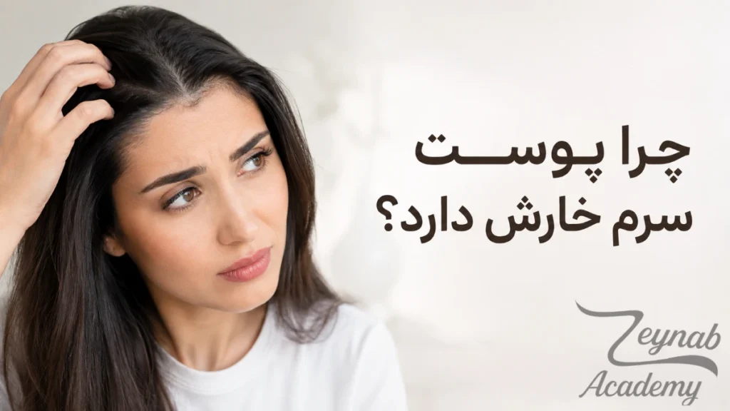 چرا پوست سرم خارش دارد و علت‌های شایع خارش پوست سر