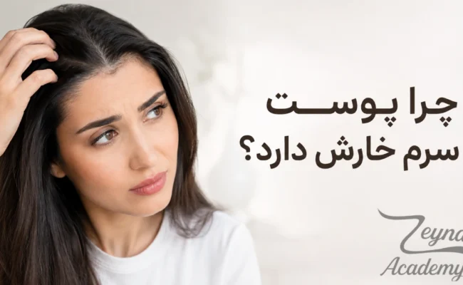 چرا پوست سرم خارش دارد و علتهای شایع خارش پوست سر