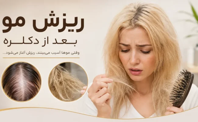 علت ریزش مو بعد از دکلره | ۹ دلیل اصلی